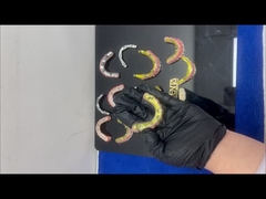 Ti-Bar 지르코니아 하이브리드 브리지