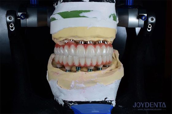 주문 10mm 길이의 단일 치아 임플란트 가마 방사선으로 최적의 수술 결과를 얻습니다. 온라인 제품