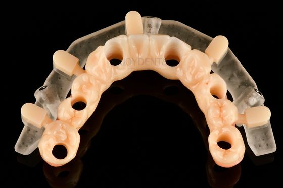 주문 정밀 임플란트 배치를 위한 3D 인쇄 가이드 수술 템플릿 온라인 제품