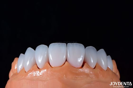 주문 0.3-0.5mm 두께 에맥스 포스텔렌 플라니어 고 광택 화장품 치과 온라인 제품
