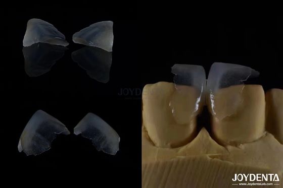주문 최소 침습성 화장품 치과 장단 유리 세라믹 색상 초 얇은 온라인 제품