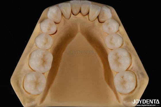 주문 3D 다층 치아 전체 지르코니아 칩 저항성 자연 치아 구조 온라인 제품