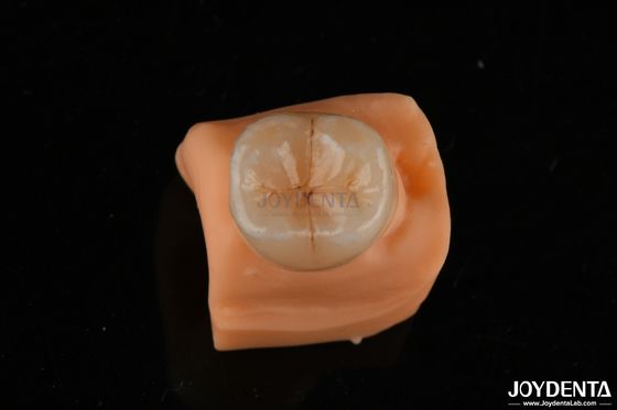 주문 0.5mm 스택 저항성 Emax 인레이 온레이 치아 복원을 위한 정확한 적합성 온라인 제품