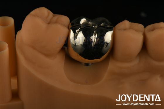 주문 구강 재활  Wax Casting FMC 치과 임상 수리용 풀 메탈 크라운 온라인 제품