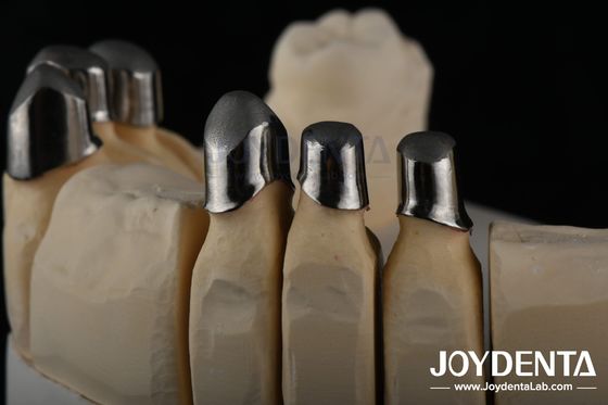 주문 강철 로케이터 치아 부착, 정밀 부분 치아 부착 온라인 제품