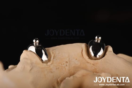 주문 Joydental 치과실술실 공 부착 온라인 제품
