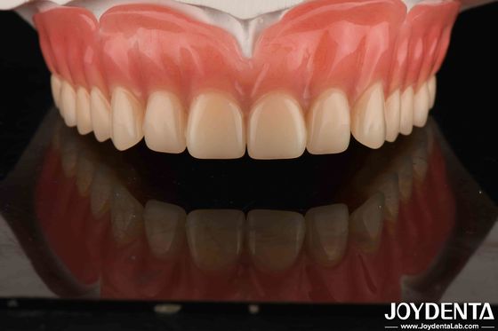 주문 아크릴 치아 가공 가벼운 樹脂 재료 치아 복원 치아 조립 온라인 제품