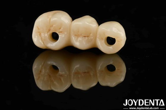 주문 높은 미학 높은 굴절 강도 1000 MPa 표준에 대한 완전한 지르코니아 온라인 제품