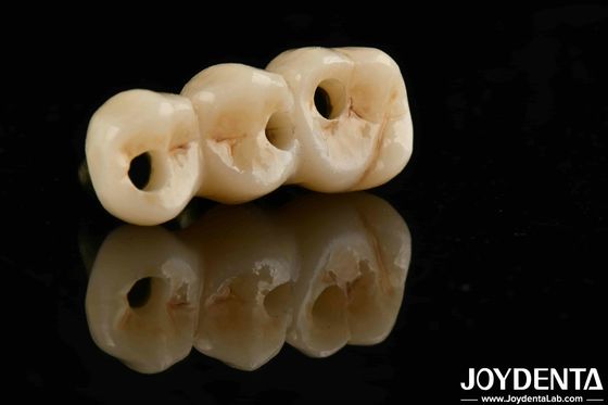 주문 우수한 생체 호환성 및 높은 강도 색상 현실적인 전체 지르코니아 B2B 조달 솔루션 온라인 제품