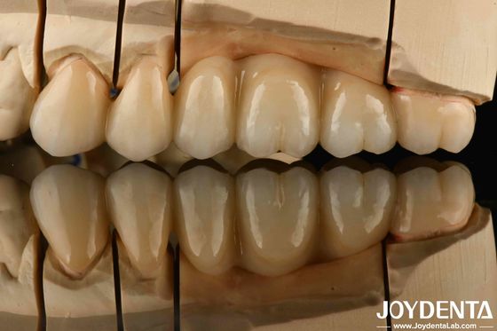 주문 화상 충격에 높은 저항을 가진 흰색 전체 Zirconia 높은 강도 온라인 제품
