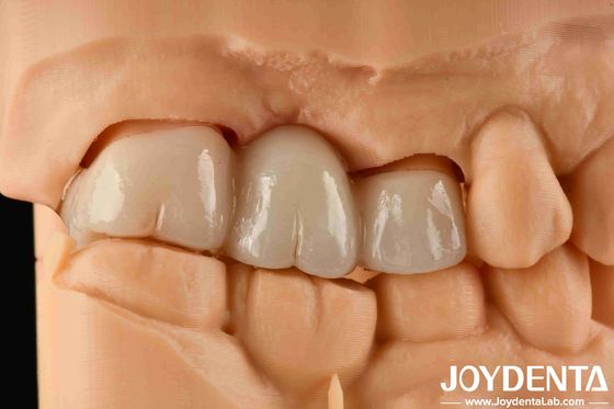 주문 경험 색상 현실적인 전체 지르코니아 염색에 대한 높은 저항과 1000 MPa의 융통 강도 온라인 제품