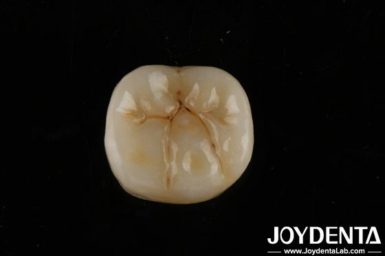 주문 높은 투명성 지르코니아 층과 함께 생물 호환성 및 구부러지기 강도 800 MPa 온라인 제품