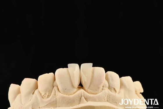 주문 높은 내구성 마이크로 플레어 0.2mm 두께와 신뢰할 수있는 성능 온라인 제품