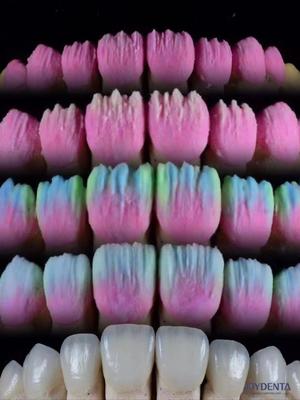 주문 The Joydenta Ceramic Veneer Process 온라인 제품