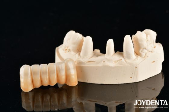 주문 Unveil True Biomimicry: Introducing Our Multi-Layered Zirconia Aesthetic Bridge 온라인 제품