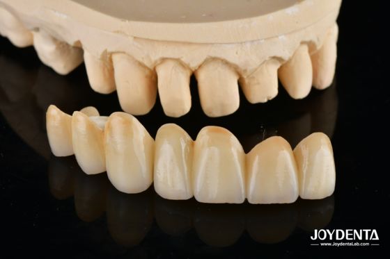 주문 Unveil True Biomimicry: Introducing Our Multi-Layered Zirconia Aesthetic Bridge 온라인 제품