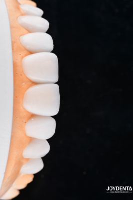 주문 Enhance Case Acceptance & Patient Communication with Our Diagnostic Wax-Up Service 온라인 제품