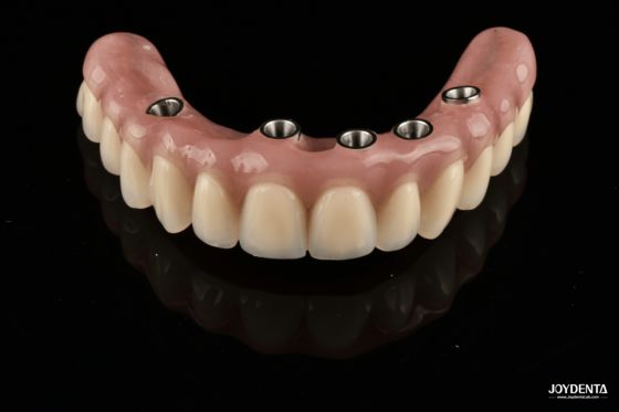 주문 Redefining Full Arch Prosthetics: Unmatched Fit and Function with Our Ti-Base Complete Dentures 온라인 제품