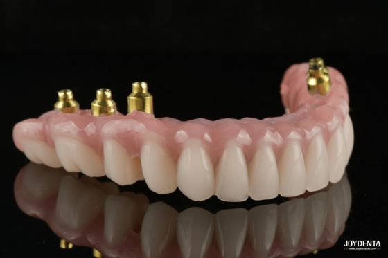 주문 The Strength of Titanium, The Art of Natural Aesthetics. 온라인 제품