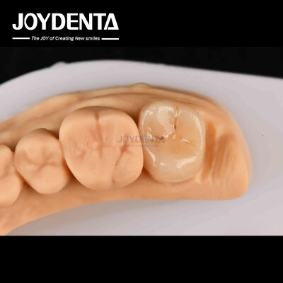 주문 고강성 Emax 인레이 온레이 A2 색상 손상된 치아 복구를 위해 오래 지속 온라인 제품