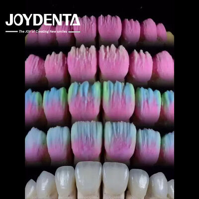 주문 The Joydenta Ceramic Veneer Process 온라인 제품
