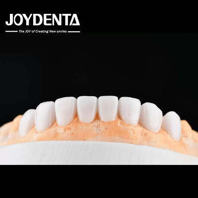 주문 Enhance Case Acceptance & Patient Communication with Our Diagnostic Wax-Up Service 온라인 제품