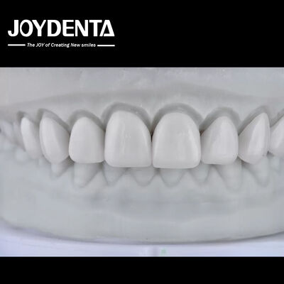 주문 Visualize the Result, Secure the Case: Our Diagnostic Wax-Up Service 온라인 제품