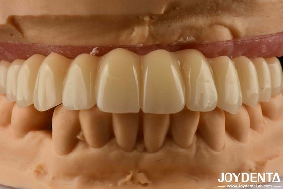 치과 용액 Ti-Base Zirconia 하이브리드 브릿지 높은 생물 호환성 자연스러운 모양
