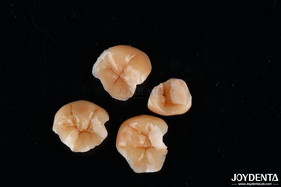 사용자 정의 가능한 모양 복합 인레이 및 온레이 치아 얼룩 저항 오래 지속