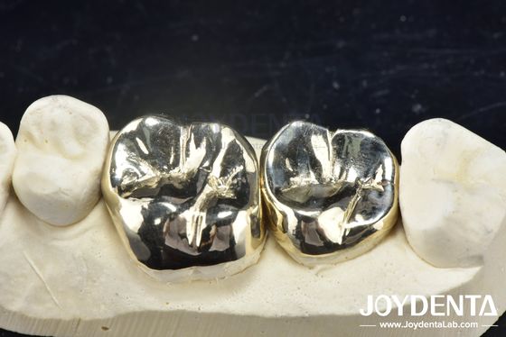 Wax Casting Dental Repair Full Metal Crown For Abrasion Resistant Oral Rehabilitation 소름에 저항하는 구강 재활용을 위한 전체 금속 왕관