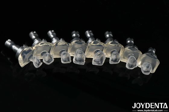 매우 투명한 유리 포르셀렌 치아 장단 고강도 0.3-0.8mm 두께