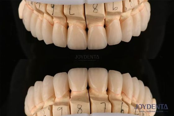닦은 계층 치아 지르코니아 0.3-0.5mm 두께 CAD CAM 기술로
