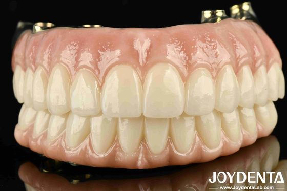 높은 내구성 Ti-Bar Zirconia 하이브리드 브릿지 개인 만족을 위해 주문 제작