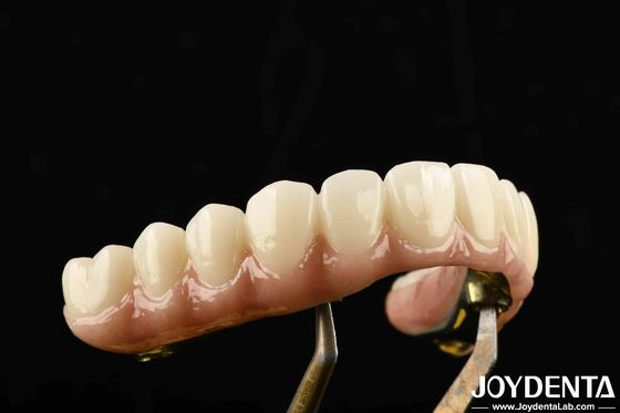 내구성 Ti-Bar Zirconia 하이브리드 브릿지 티타늄과 지르코니아 재료로 만든 무거운 US