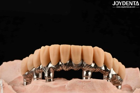 노란색 레진 임시 치아 매끄러운 표면 처리 정밀하고 안정적