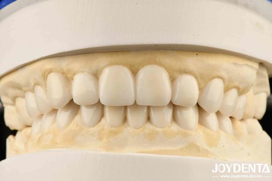 치과 바이오 미메틱 에스테틱 디아그노스틱 백스업