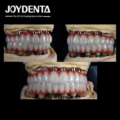10mm 티타늄 복수 치아 임플란트 치아 복원을 위한 거친 표면