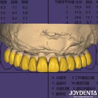 이름