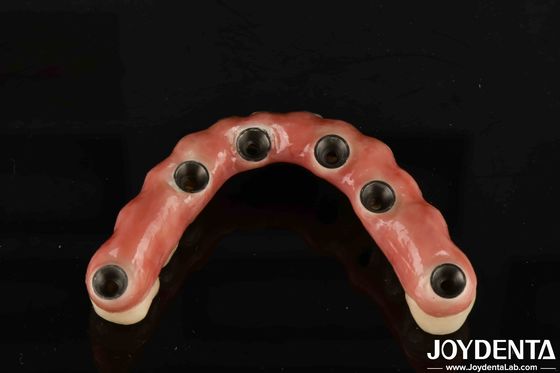 이름