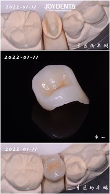 이름